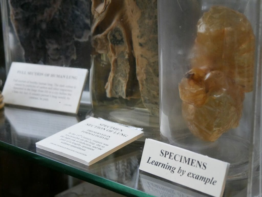 Specimens in a jar at the Old Operating Theatre, London